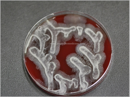 Perfect sterilization