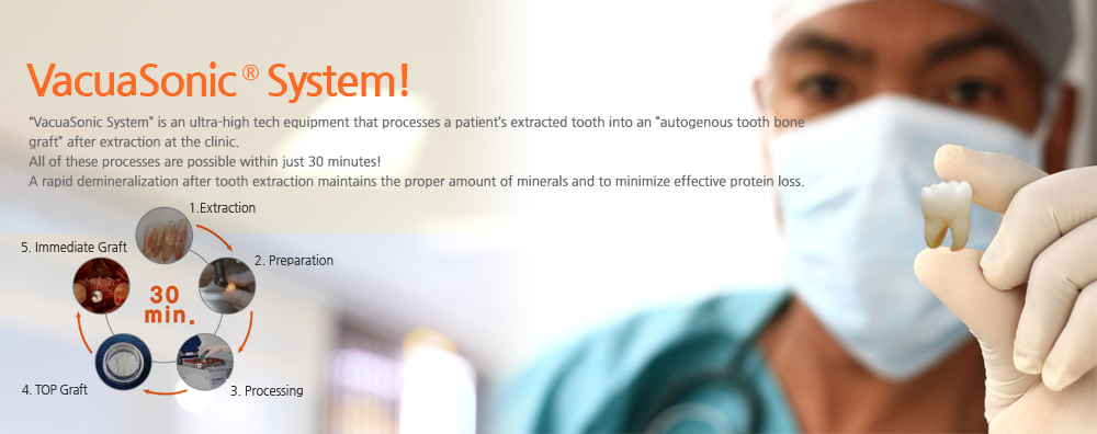 Keep your teeth!-VacuaSonic System of the patient's own teeth extractions in the office for 30 minutes, but a state-of-the-art rapid demineralized bone graft material made ​​equipment.
